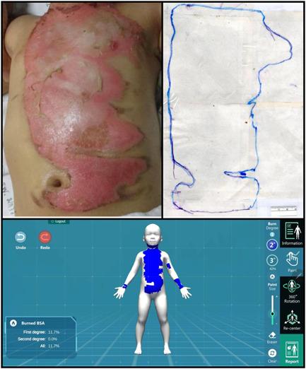 https://cdn.ncbi.nlm.nih.gov/pmc/blobs/9bfa/9203995/fd91ae1151b7/HSR2-5-e694-g001.jpg