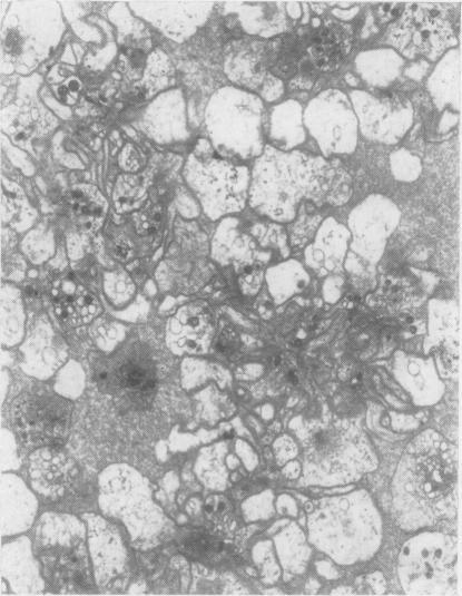 https://cdn.ncbi.nlm.nih.gov/pmc/blobs/9bfc/474212/8d977bf86a66/jclinpath00381-0080-b.jpg