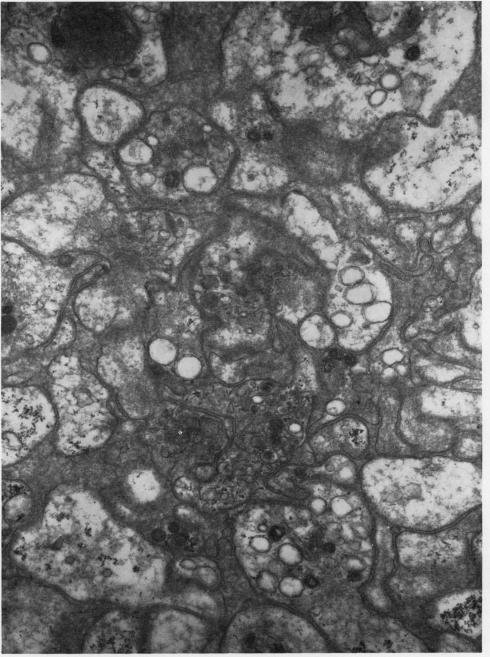 https://cdn.ncbi.nlm.nih.gov/pmc/blobs/9bfc/474212/f481a2dafc83/jclinpath00381-0081-a.jpg