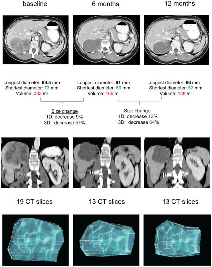 https://cdn.ncbi.nlm.nih.gov/pmc/blobs/9c01/3487791/b70865ca8b82/pone.0048372.g002.jpg