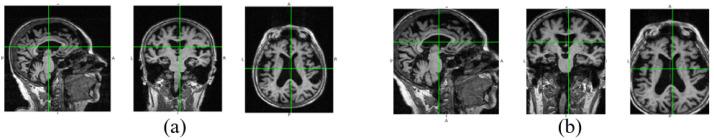 https://cdn.ncbi.nlm.nih.gov/pmc/blobs/9c07/8623279/c9671064ac81/sensors-21-07634-g003.jpg