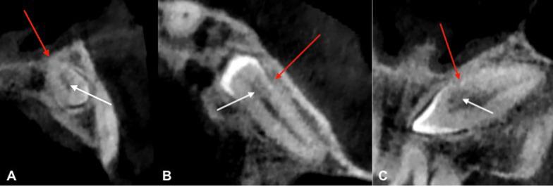 https://cdn.ncbi.nlm.nih.gov/pmc/blobs/9c0a/12089639/082315e35159/40729_2025_626_Fig3_HTML.jpg