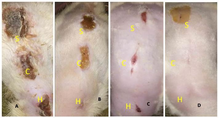 https://cdn.ncbi.nlm.nih.gov/pmc/blobs/9c0e/6137850/ae87465b5724/gr1.jpg