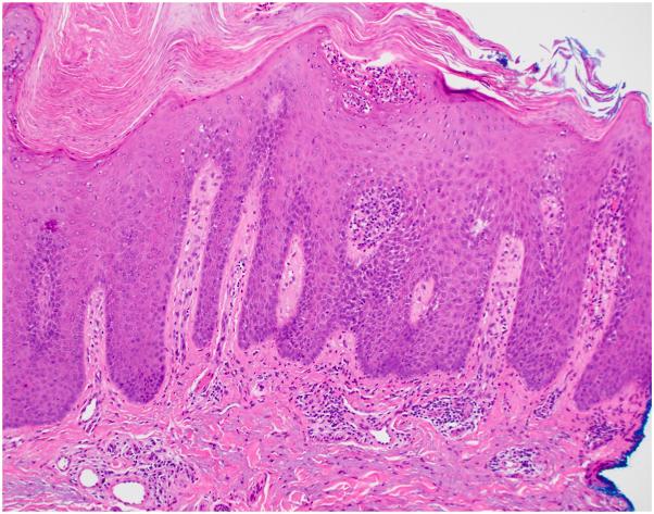 https://cdn.ncbi.nlm.nih.gov/pmc/blobs/9c0f/12269876/7bdc2e0d8469/gr2.jpg