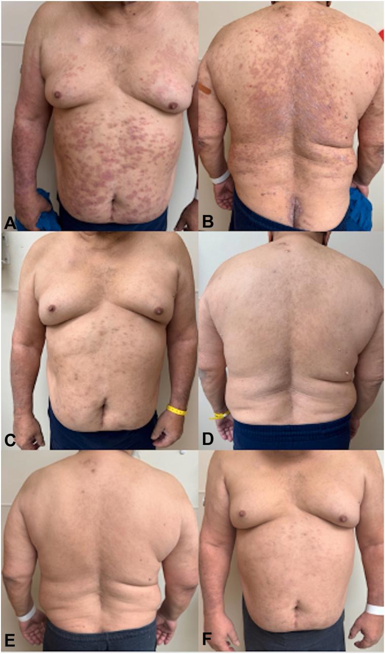 https://cdn.ncbi.nlm.nih.gov/pmc/blobs/9c0f/12269876/7db93cac4d7b/gr3.jpg