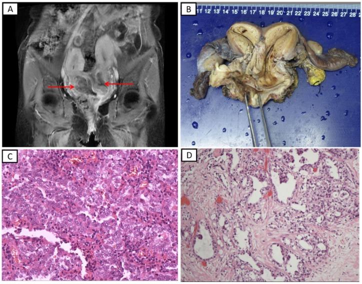 https://cdn.ncbi.nlm.nih.gov/pmc/blobs/9c14/6590040/84ef1f2ed21f/jcav10p3054g001.jpg