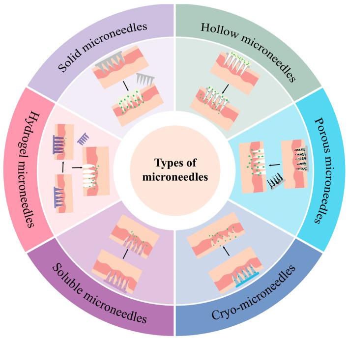 https://cdn.ncbi.nlm.nih.gov/pmc/blobs/9c17/12115605/f80a10fd4d26/vaccines-13-00469-g002.jpg