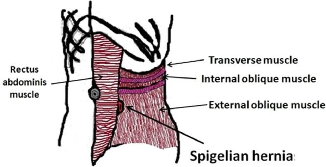 https://cdn.ncbi.nlm.nih.gov/pmc/blobs/9c1f/11143774/3e58335f173f/gr1.jpg