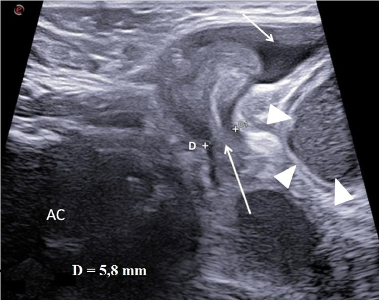 https://cdn.ncbi.nlm.nih.gov/pmc/blobs/9c1f/11143774/6c6596783d15/gr2.jpg