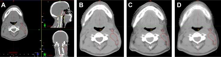 https://cdn.ncbi.nlm.nih.gov/pmc/blobs/9c20/4576892/20b61c66826c/ott-8-2545Fig2.jpg