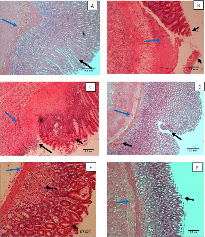 https://cdn.ncbi.nlm.nih.gov/pmc/blobs/9c23/6544613/149cfd32e927/gr4.jpg