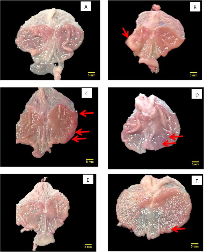 https://cdn.ncbi.nlm.nih.gov/pmc/blobs/9c23/6544613/cb943d588970/gr1.jpg