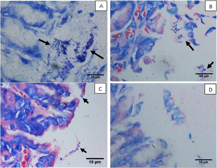 https://cdn.ncbi.nlm.nih.gov/pmc/blobs/9c23/6544613/e2d5b3b230af/gr5.jpg