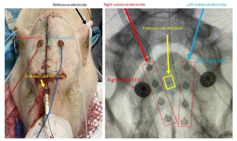 https://cdn.ncbi.nlm.nih.gov/pmc/blobs/9c27/8946704/90b61aebf41f/brainsci-12-00309-g002.jpg