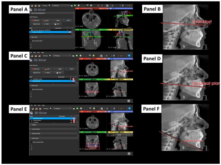 https://cdn.ncbi.nlm.nih.gov/pmc/blobs/9c33/11506368/23c07cfd6d80/dentistry-12-00316-g001.jpg