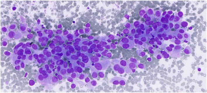 https://cdn.ncbi.nlm.nih.gov/pmc/blobs/9c39/12377497/3b47db433ee0/CNCY-133-0-g001.jpg