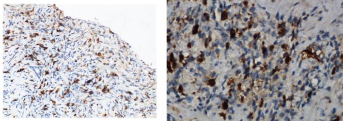 https://cdn.ncbi.nlm.nih.gov/pmc/blobs/9c3b/8960130/2525eff303f8/fimmu-13-816830-g002.jpg