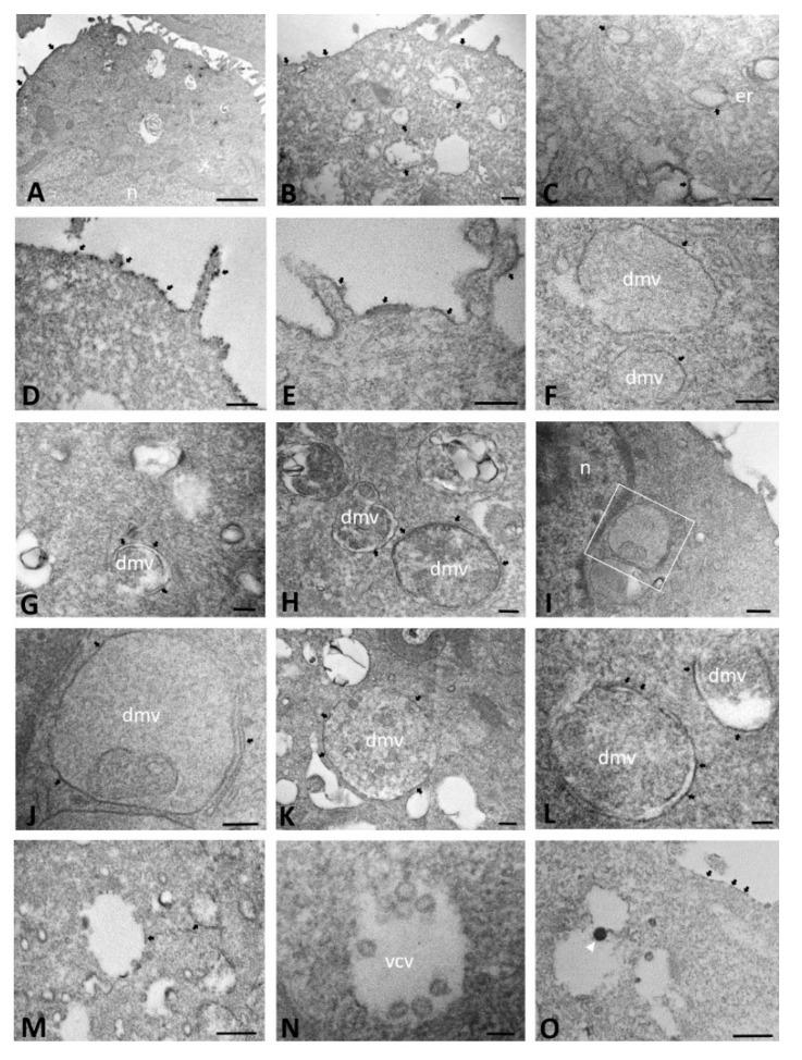 https://cdn.ncbi.nlm.nih.gov/pmc/blobs/9c4d/9455986/d20c36aac7f7/ijms-23-09724-g008.jpg