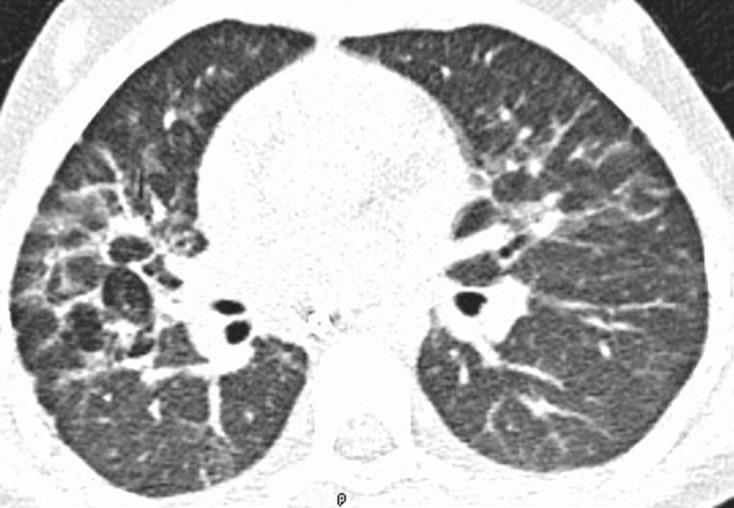 https://cdn.ncbi.nlm.nih.gov/pmc/blobs/9c50/7869130/26de58126d30/bjrcr.20200062.g008.jpg