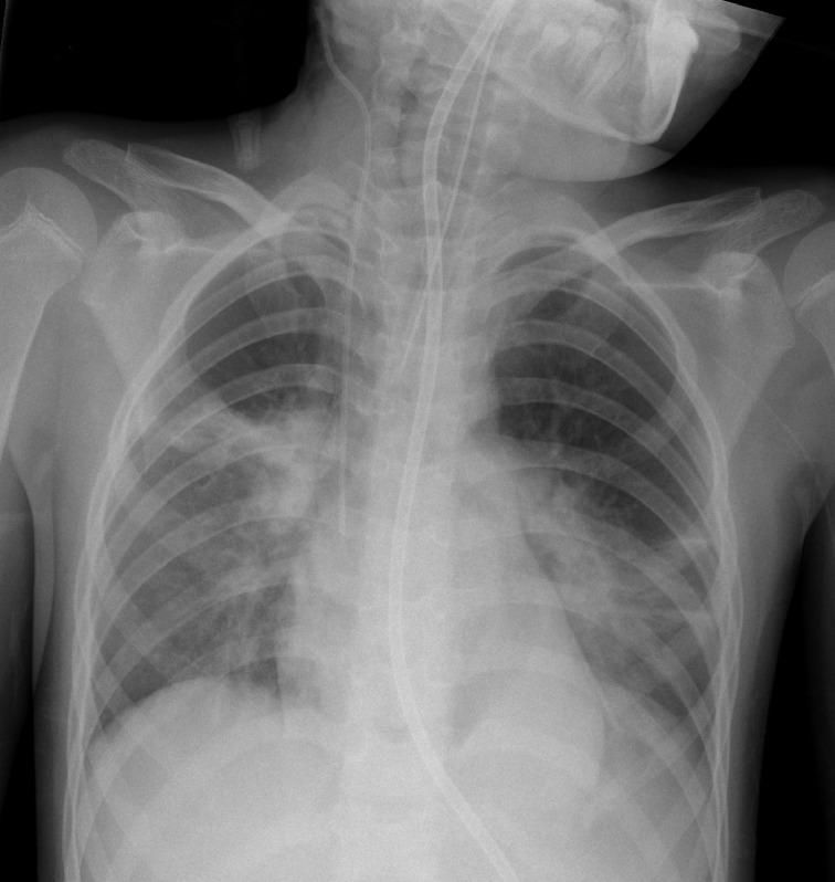 https://cdn.ncbi.nlm.nih.gov/pmc/blobs/9c50/7869130/9b9a6f9c1351/bjrcr.20200062.g004.jpg