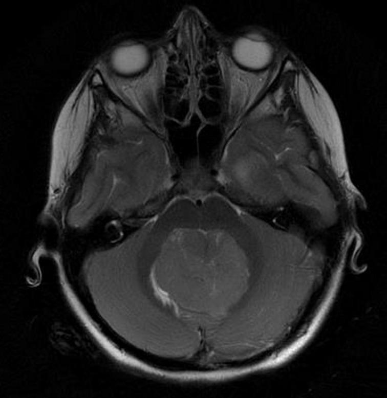 https://cdn.ncbi.nlm.nih.gov/pmc/blobs/9c50/7869130/f55fca1ec99e/bjrcr.20200062.g001.jpg