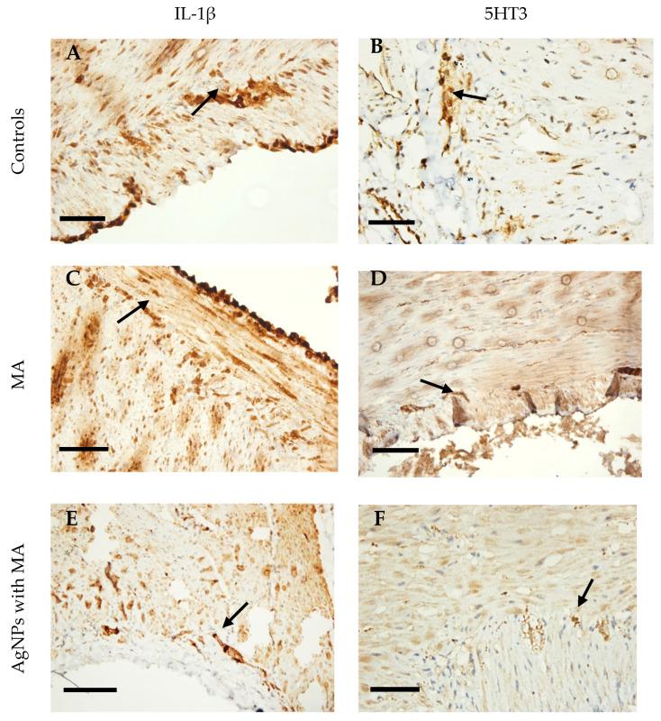 https://cdn.ncbi.nlm.nih.gov/pmc/blobs/9c51/12157222/36dbf557400b/nanomaterials-15-00815-g006.jpg