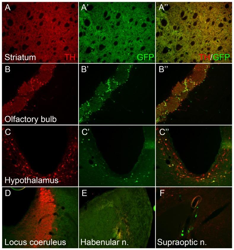 https://cdn.ncbi.nlm.nih.gov/pmc/blobs/9c53/4251919/5dd5f520677f/pone.0113151.g002.jpg