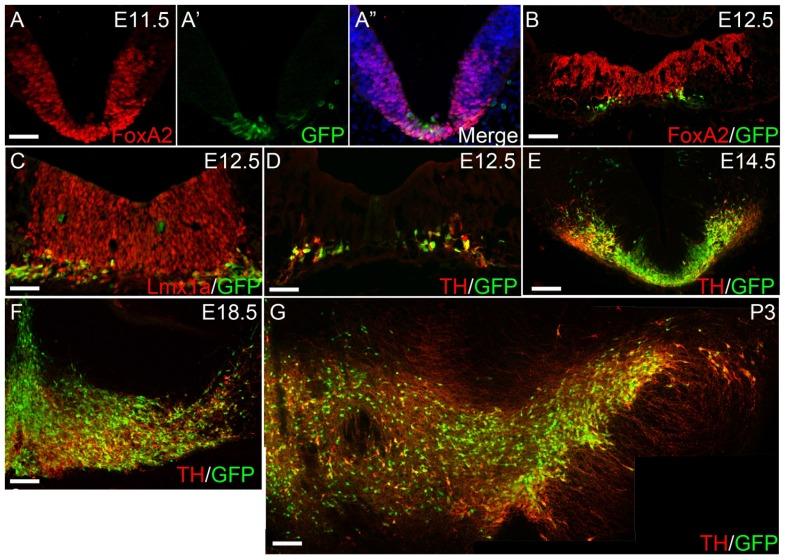 https://cdn.ncbi.nlm.nih.gov/pmc/blobs/9c53/4251919/d7409dcbeace/pone.0113151.g003.jpg