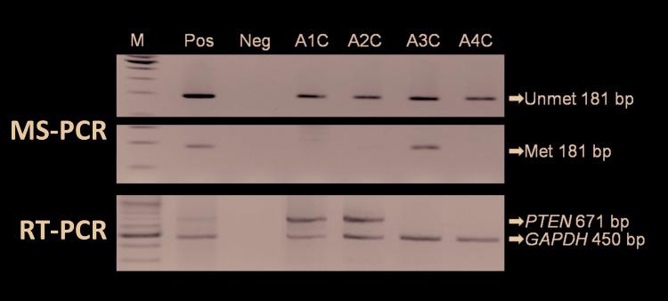 https://cdn.ncbi.nlm.nih.gov/pmc/blobs/9c5b/7338066/e2e8a6962a38/medoral-25-e481-g003.jpg