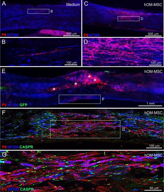 https://cdn.ncbi.nlm.nih.gov/pmc/blobs/9c66/5324664/35624ad43950/GLIA-65-639-g008.jpg