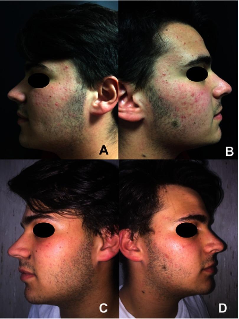 https://cdn.ncbi.nlm.nih.gov/pmc/blobs/9c69/6526677/0e65a1693efb/CCID-12-363-g0001.jpg