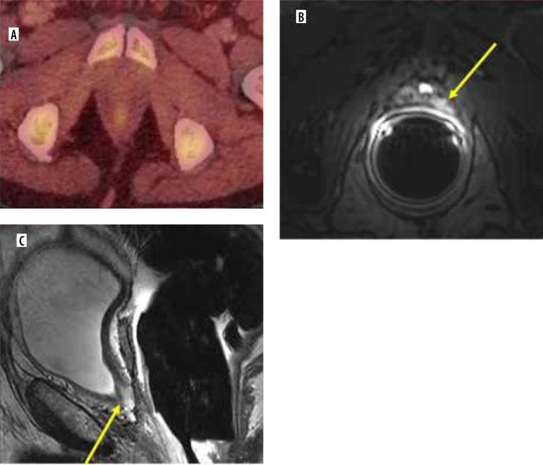 https://cdn.ncbi.nlm.nih.gov/pmc/blobs/9c6e/11112415/aefbb4c4e671/PJR-89-184029-g002.jpg