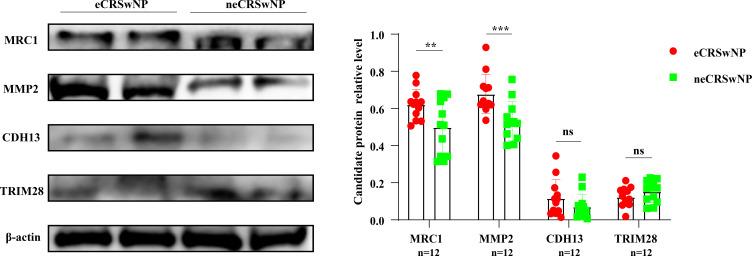 https://cdn.ncbi.nlm.nih.gov/pmc/blobs/9c7f/10859095/608dfecad7ee/JIR-17-805-g0006.jpg