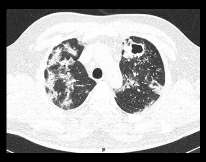 https://cdn.ncbi.nlm.nih.gov/pmc/blobs/9c86/7649741/6f2eaf7ee8d3/amjcaserep-21-e927628-g001.jpg
