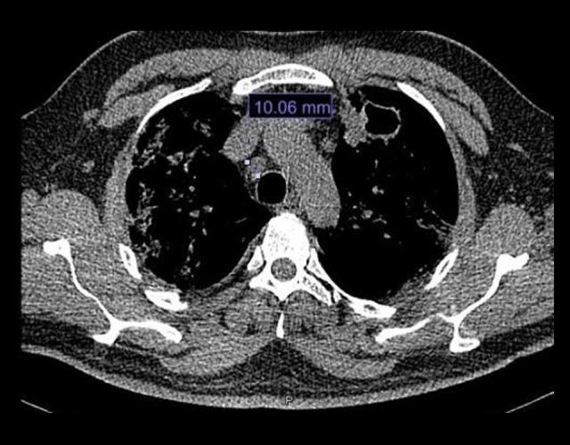 https://cdn.ncbi.nlm.nih.gov/pmc/blobs/9c86/7649741/916e46d11a49/amjcaserep-21-e927628-g004.jpg