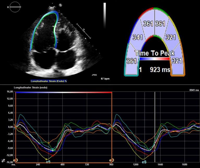 https://cdn.ncbi.nlm.nih.gov/pmc/blobs/9c8e/10806502/73057bb565de/openhrt-2023-002583f01.jpg