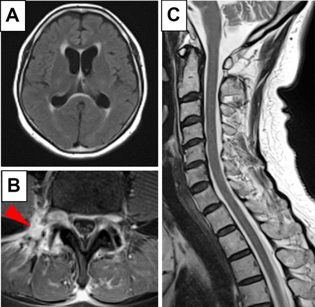 https://cdn.ncbi.nlm.nih.gov/pmc/blobs/9c8f/10749799/7340518e48f5/1349-7235-62-3531-g003.jpg