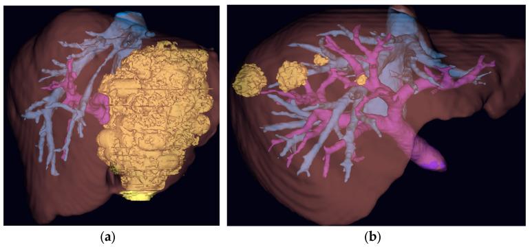 https://cdn.ncbi.nlm.nih.gov/pmc/blobs/9c92/12347794/bcd0be6d759d/jcm-14-05385-g003.jpg