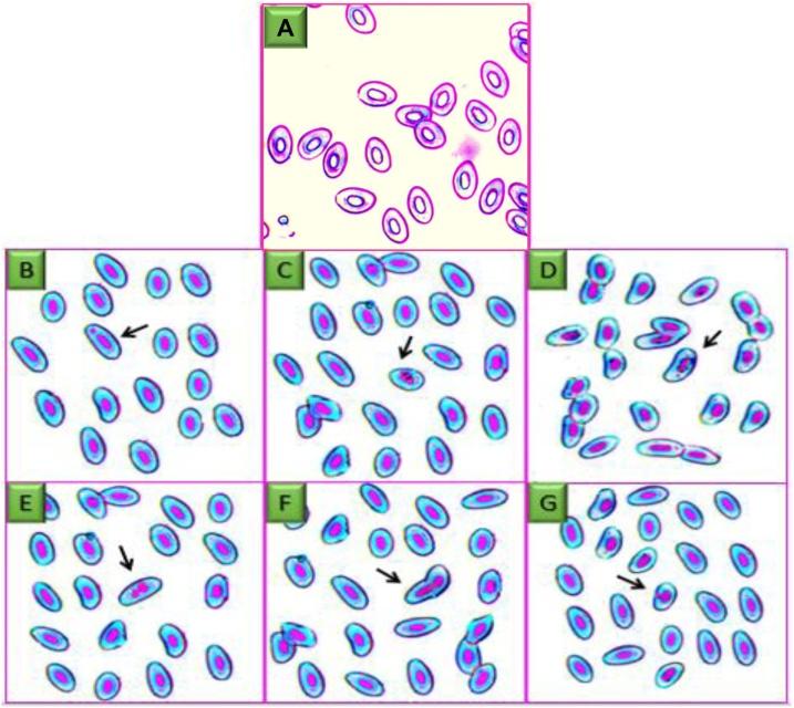 https://cdn.ncbi.nlm.nih.gov/pmc/blobs/9ca0/7930503/a5e2ce690812/gr1.jpg