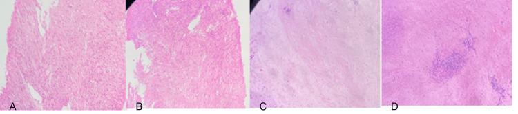 https://cdn.ncbi.nlm.nih.gov/pmc/blobs/9ca2/10244938/cae68e07e518/cureus-0015-00000038690-i02.jpg