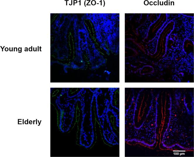 https://cdn.ncbi.nlm.nih.gov/pmc/blobs/9ca8/6965102/e658b02ceec9/41598_2019_57106_Fig4_HTML.jpg
