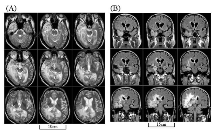 https://cdn.ncbi.nlm.nih.gov/pmc/blobs/9cb6/11761159/119a50d823ff/cureus-0016-00000076385-i05.jpg