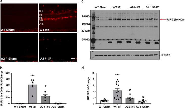 https://cdn.ncbi.nlm.nih.gov/pmc/blobs/9cb7/5260867/569caa66ce22/cddis2016295f3.jpg