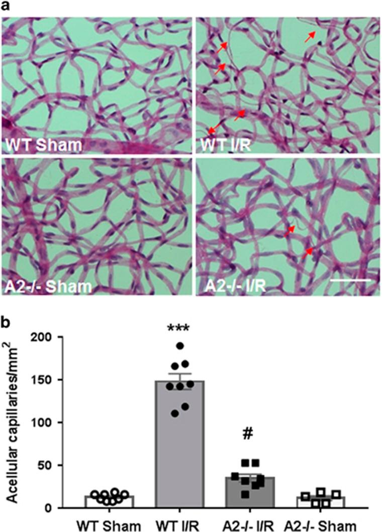https://cdn.ncbi.nlm.nih.gov/pmc/blobs/9cb7/5260867/9837354224ce/cddis2016295f5.jpg