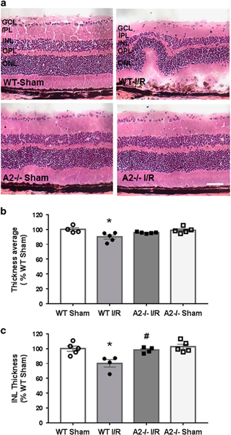 https://cdn.ncbi.nlm.nih.gov/pmc/blobs/9cb7/5260867/ee5fdb15d433/cddis2016295f2.jpg