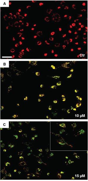 https://cdn.ncbi.nlm.nih.gov/pmc/blobs/9cba/5045361/111f688db2e3/oncotarget-07-28849-g003.jpg
