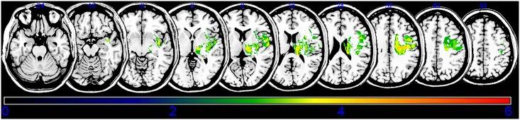 https://cdn.ncbi.nlm.nih.gov/pmc/blobs/9cbb/6345431/3f9249489c1e/pone.0210038.g003.jpg