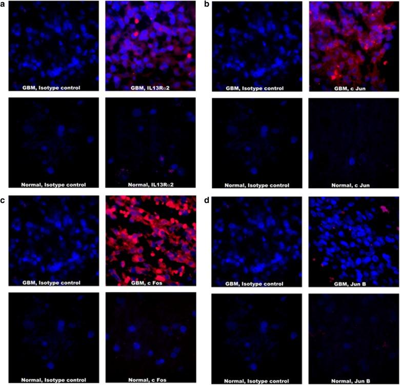 https://cdn.ncbi.nlm.nih.gov/pmc/blobs/9cbe/6302477/ca42566842c2/12967_2018_1746_Fig4_HTML.jpg