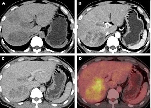 https://cdn.ncbi.nlm.nih.gov/pmc/blobs/9cc5/4937684/e55fceb7318d/AOJNMB-3-10-g004.jpg