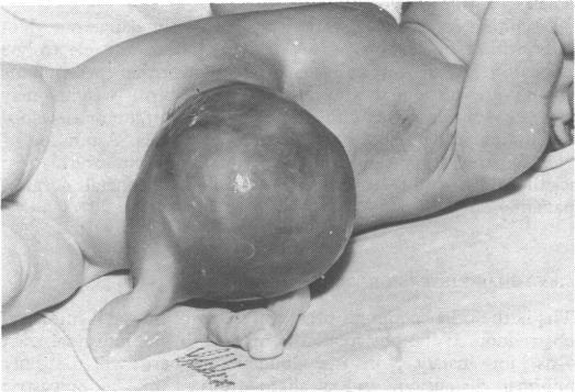 https://cdn.ncbi.nlm.nih.gov/pmc/blobs/9cc7/1799587/9b57643bac10/brmedj02673-0055-c.jpg